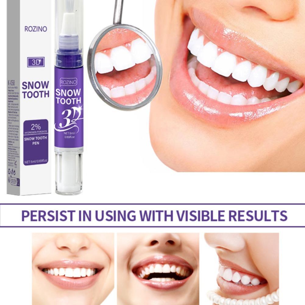 Unisex Oral Dental Care Pen An - đánh giá và giá Teeth Whitening Pens